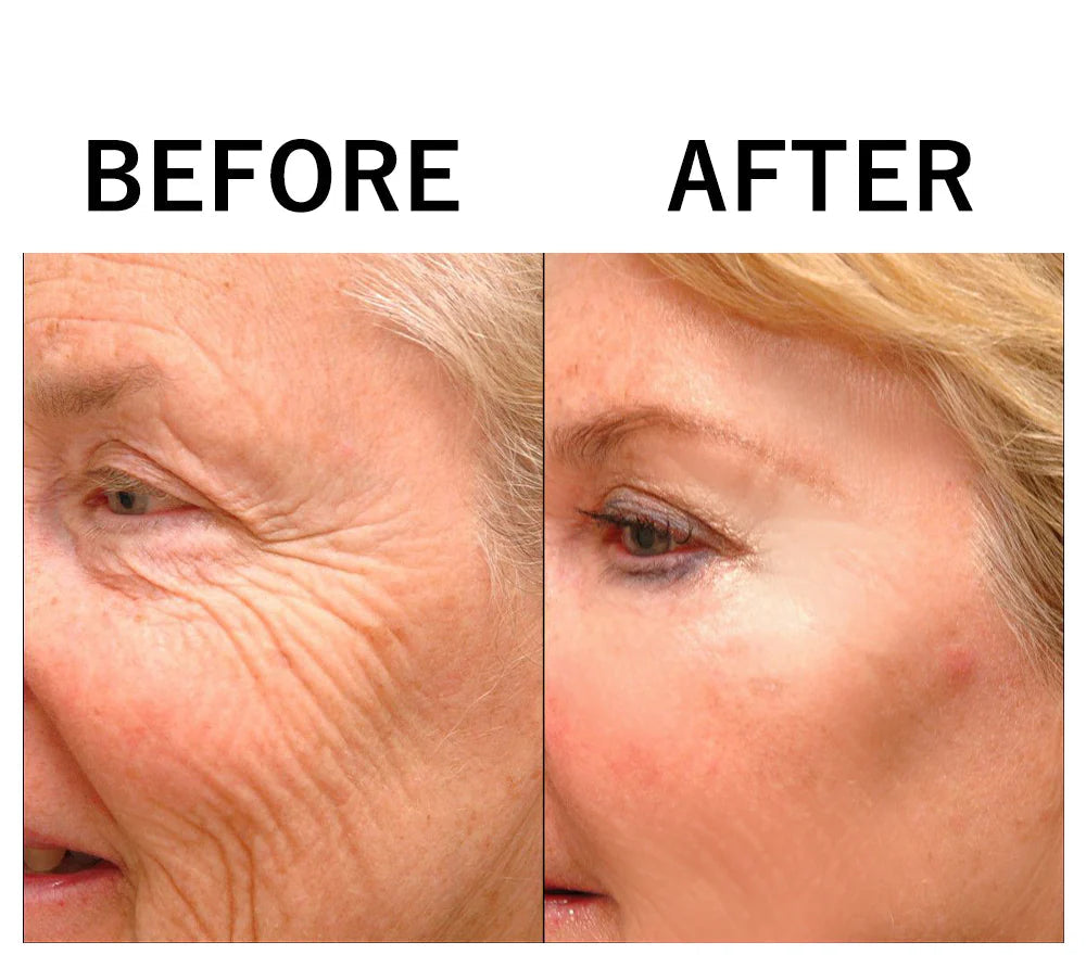 Sentus™ Face Tightener Serum